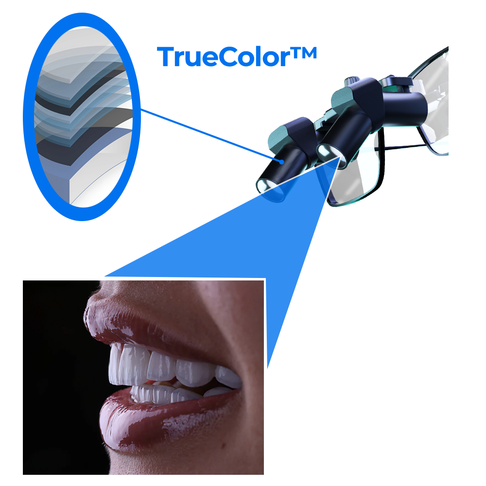 Flip-Up vs. TTL: What’s the Best Type of Dental Loupes with Light for You?